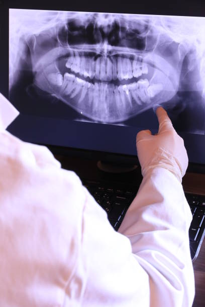 Best Cracked Tooth Emergency Dentist  in Portola Valley, CA